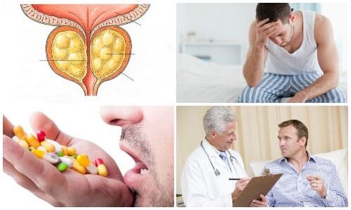 ерлердегі простатит