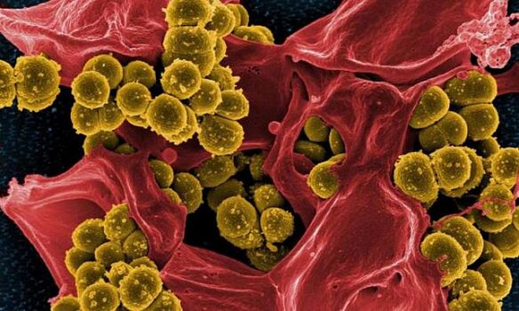 Staphylococcus aureus бактериялық простатиттің себебі ретінде